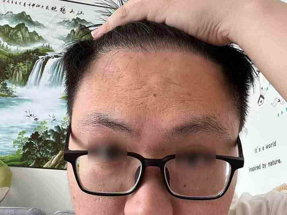 After