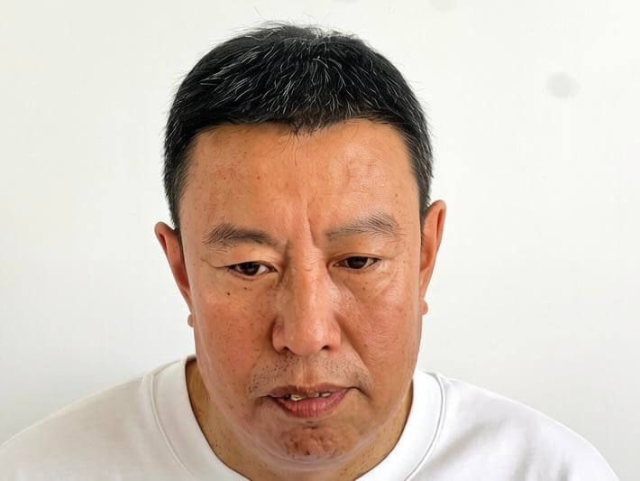 术后